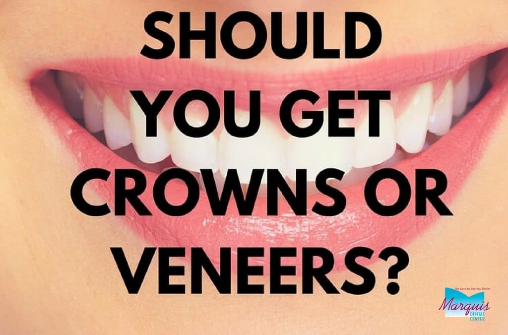 Veneers or Crowns:  Which Is Right For Me?